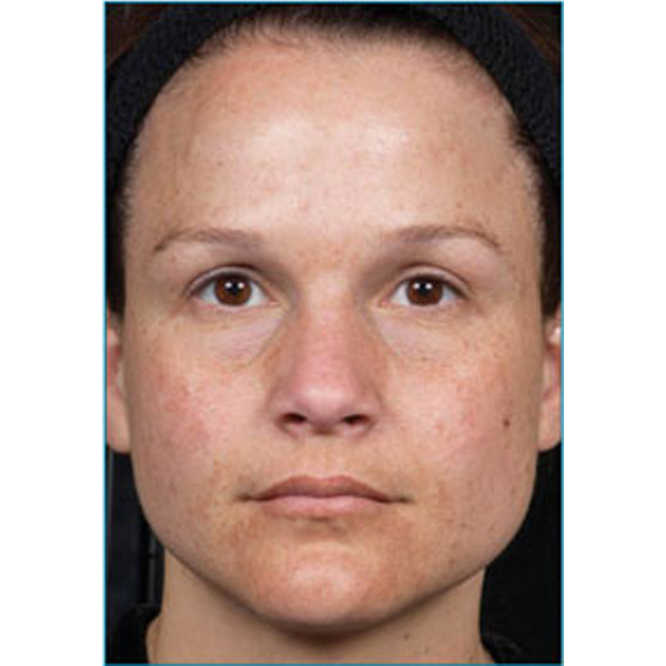 Ridgefield Aesthetics Medical Spa